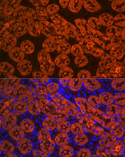 FBP1 Rabbit mAb