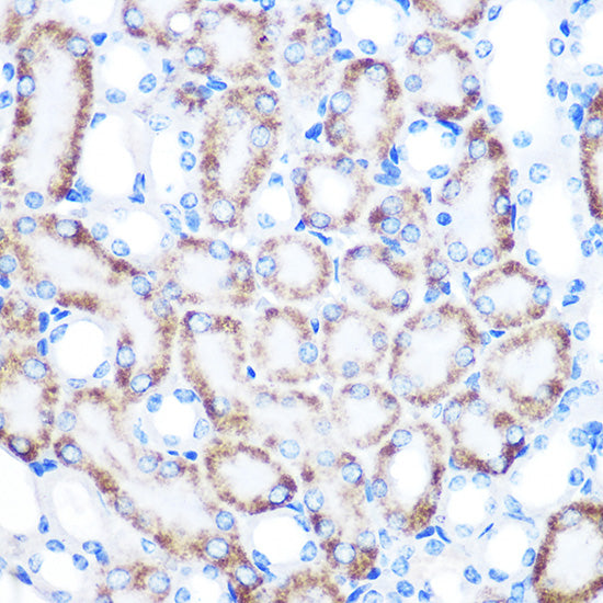 CD168/RHAMM Rabbit mAb