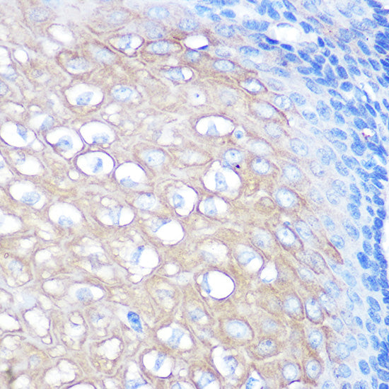 CD168/RHAMM Rabbit mAb