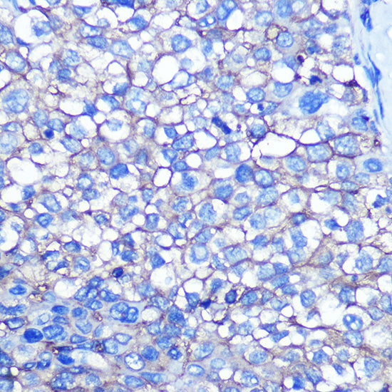 CD13/ANPEP Rabbit mAb