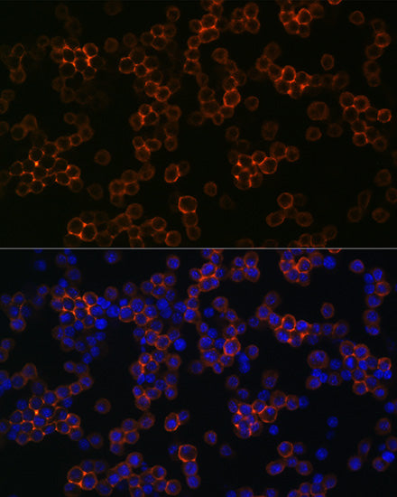CD13/ANPEP Rabbit mAb