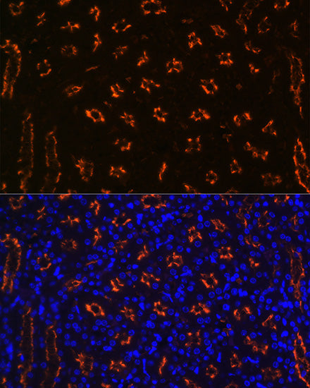 CD13/ANPEP Rabbit mAb