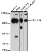 CD127/IL7R Rabbit mAb