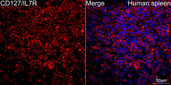 CD127/IL7R Rabbit mAb
