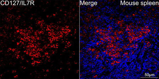 CD127/IL7R Rabbit mAb