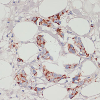 ACSL3 Rabbit pAb