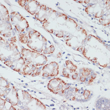 ACSL3 Rabbit pAb