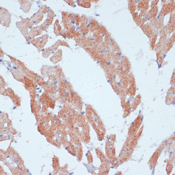ACSL3 Rabbit pAb
