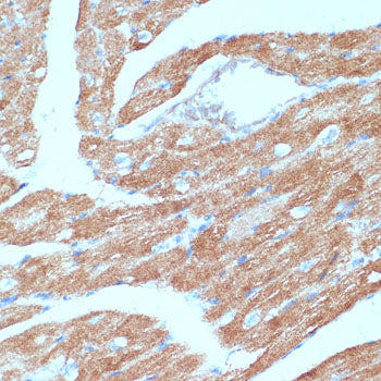 ACSL3 Rabbit pAb