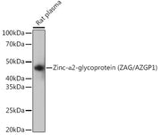Zinc-α2-glycoprotein (ZAG/AZGP1) Rabbit mAb