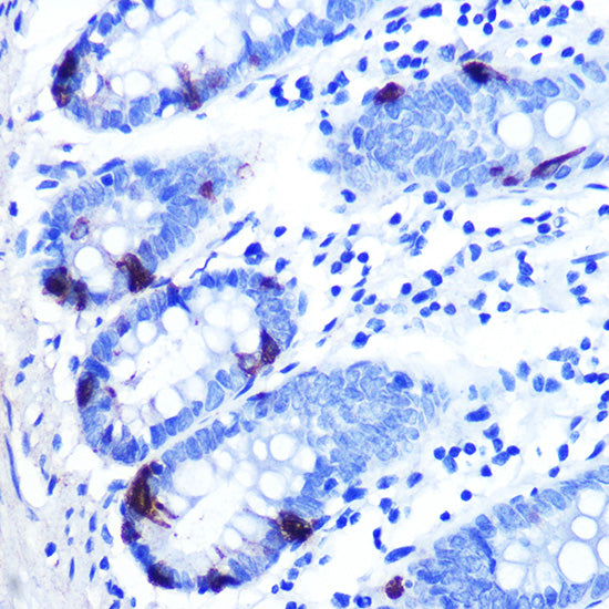 Zinc-α2-glycoprotein (ZAG/AZGP1) Rabbit mAb