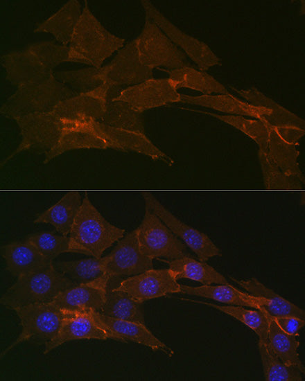 Na+/K+-ATPase Rabbit mAb