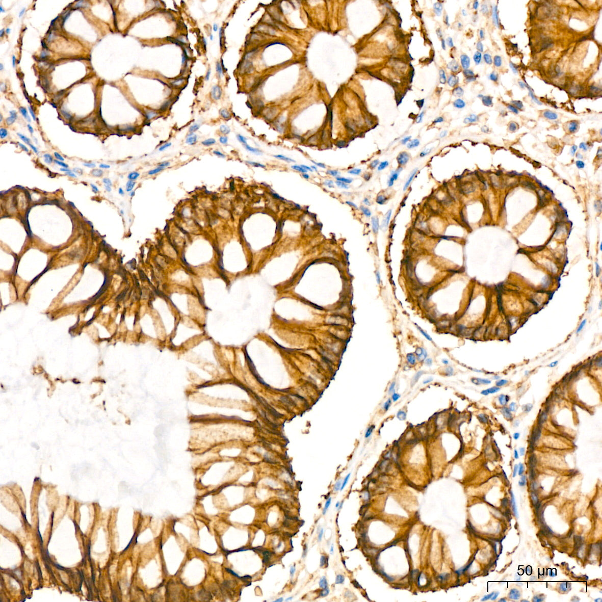 Na+/K+-ATPase Rabbit mAb