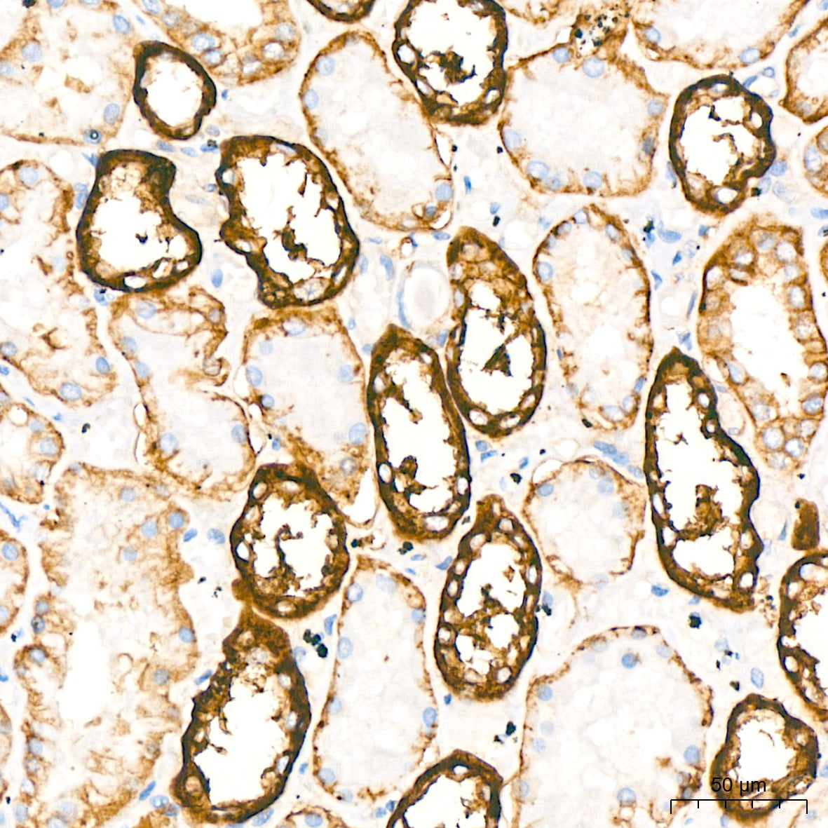 Na+/K+-ATPase Rabbit mAb