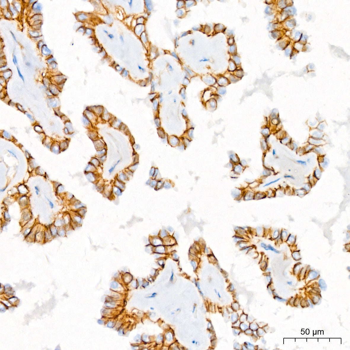 Na+/K+-ATPase Rabbit mAb