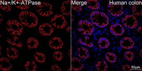 Na+/K+-ATPase Rabbit mAb