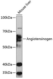 Angiotensinogen Rabbit mAb