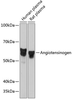Angiotensinogen Rabbit mAb