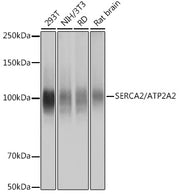 SERCA2/ATP2A2 Rabbit mAb