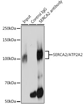 SERCA2/ATP2A2 Rabbit mAb