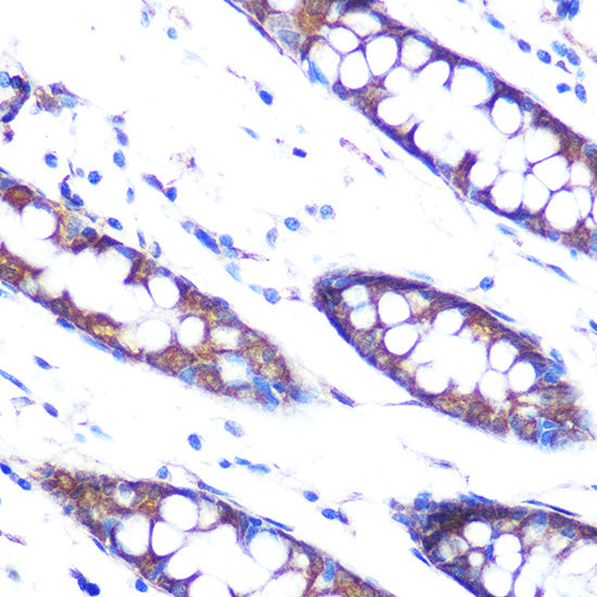 HSP47/SERPINH1 Rabbit mAb