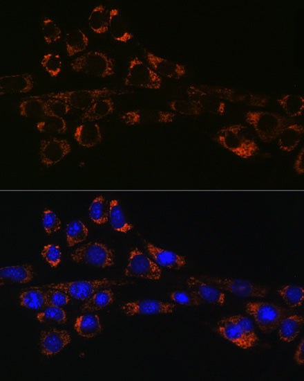 HSP47/SERPINH1 Rabbit mAb
