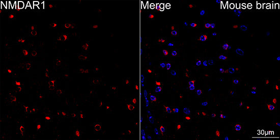 NMDAR1 Rabbit mAb