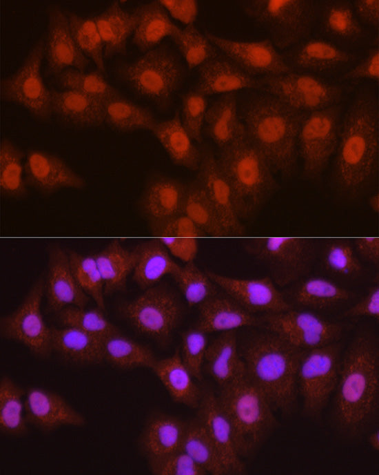 ASC/TMS1 Rabbit pAb