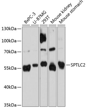 SPTLC2 Rabbit pAb