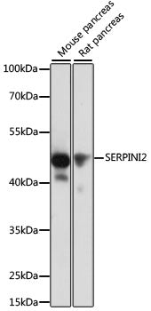 SERPINI2 Rabbit pAb