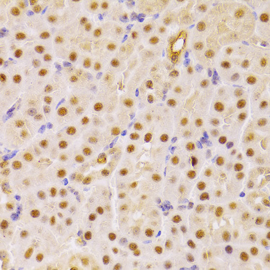CDC25A Rabbit pAb