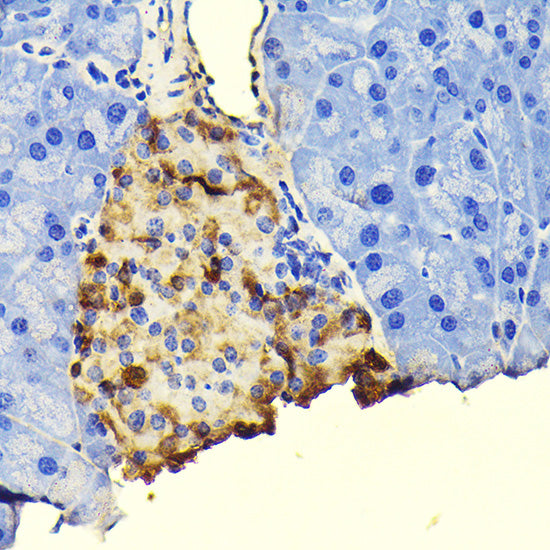 Glucagon Rabbit mAb