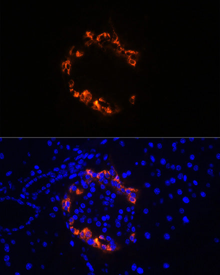 Glucagon Rabbit mAb