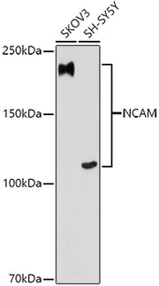 NCAM Rabbit mAb