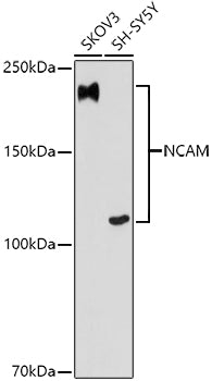 NCAM Rabbit mAb