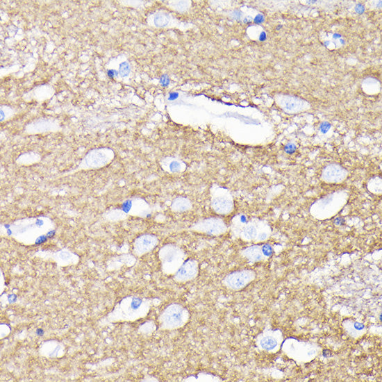 NCAM Rabbit mAb