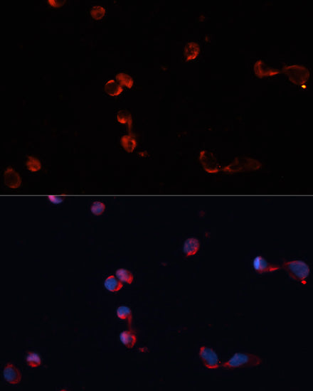 Catalase Rabbit pAb
