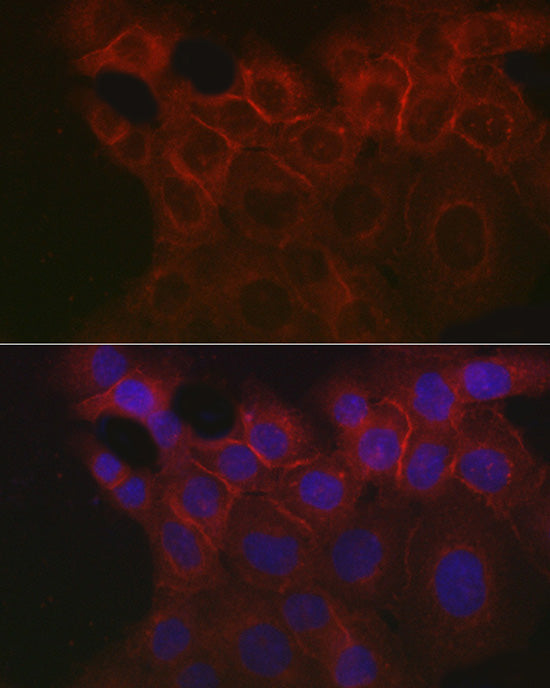 EpCAM Rabbit pAb