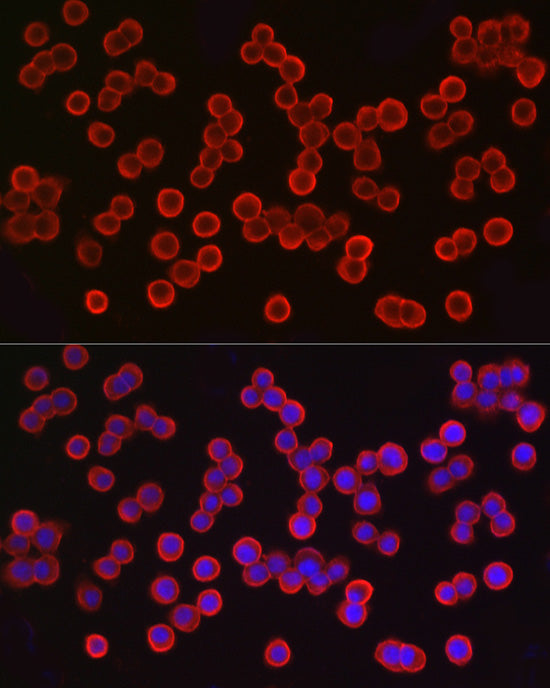 EpCAM Rabbit pAb