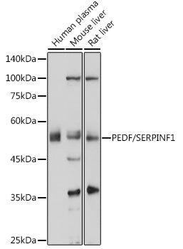 PEDF/SERPINF1 Rabbit pAb