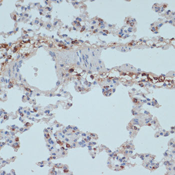 HLA-DRA Rabbit pAb