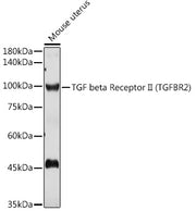 TGF beta Receptor II Rabbit pAb