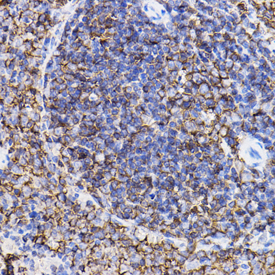 TGF beta Receptor II Rabbit pAb