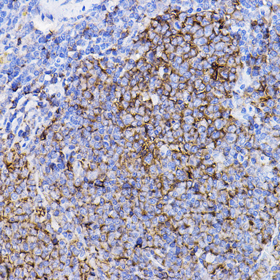 TGF beta Receptor II Rabbit pAb