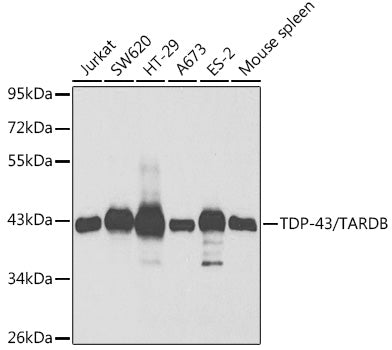 TDP-43/TARDBP Rabbit pAb