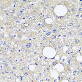 Alpha-Fetoprotein (AFP) Mouse mAb