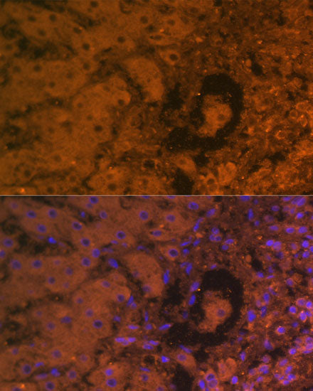 Alpha-Fetoprotein (AFP) Mouse mAb