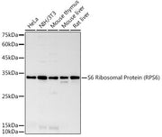 S6 Ribosomal Protein (RPS6) Rabbit mAb