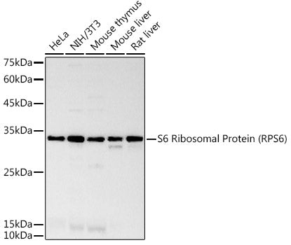 S6 Ribosomal Protein (RPS6) Rabbit mAb