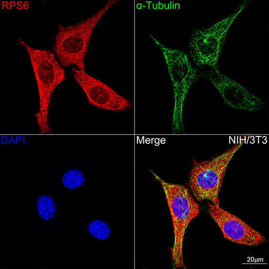 S6 Ribosomal Protein (RPS6) Rabbit mAb